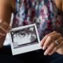 Láthatatlan gyász - A pre- és perinatális veszteségek sajátossági és kísérése